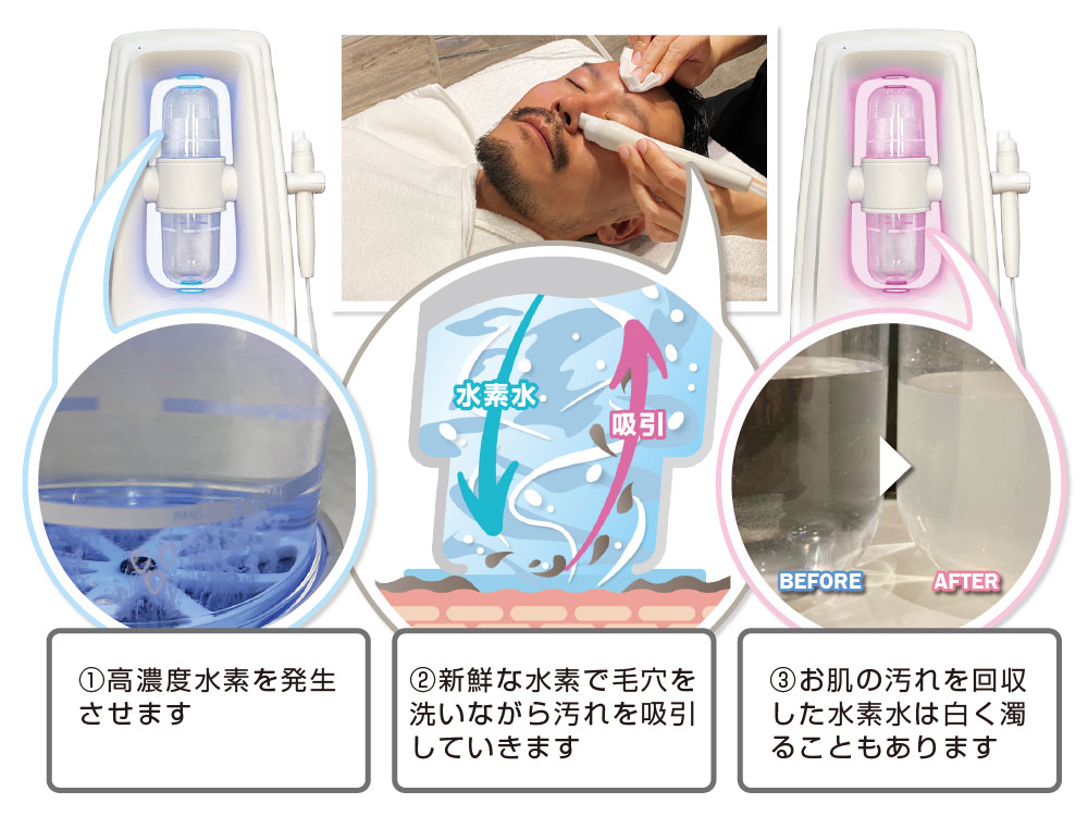 サイズ交換ＯＫ】 毛穴吸引 毛穴洗浄 ハイドロスプラッシュ ハイドラ ...